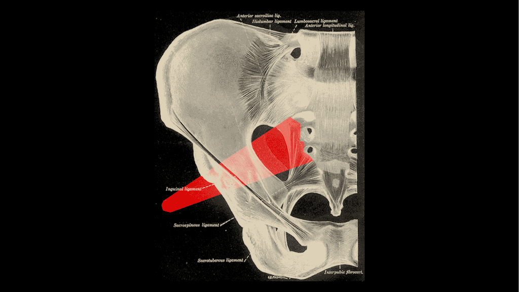 M. Piriformis: Kleiner Muskel - große Probleme 6